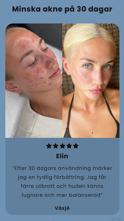 SENAX Acne Spot Treatment